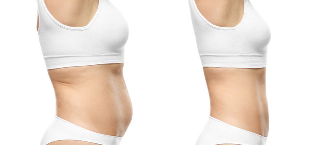 Young woman before and after weight loss on white background